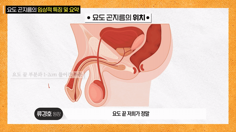 Doctor actively gesturing with hands to explain the depth and location of urethral lesions